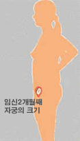 엄마의 변화 : 임신 2개월 째 자궁의 크기 이미지