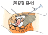 복강경 검사 이미지