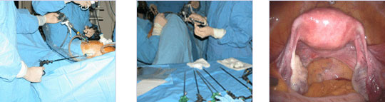 진단복강경검사 이미지